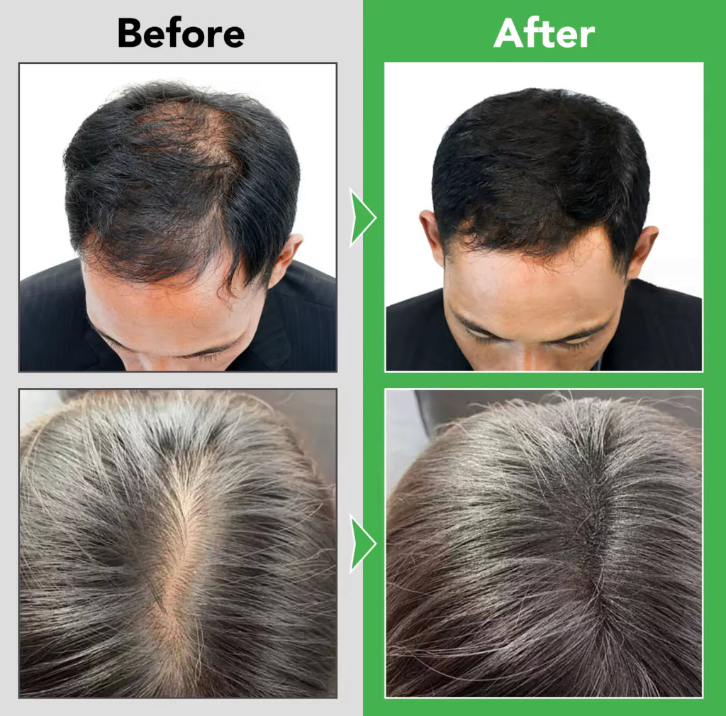 Rosemary Strengthening Shampoo