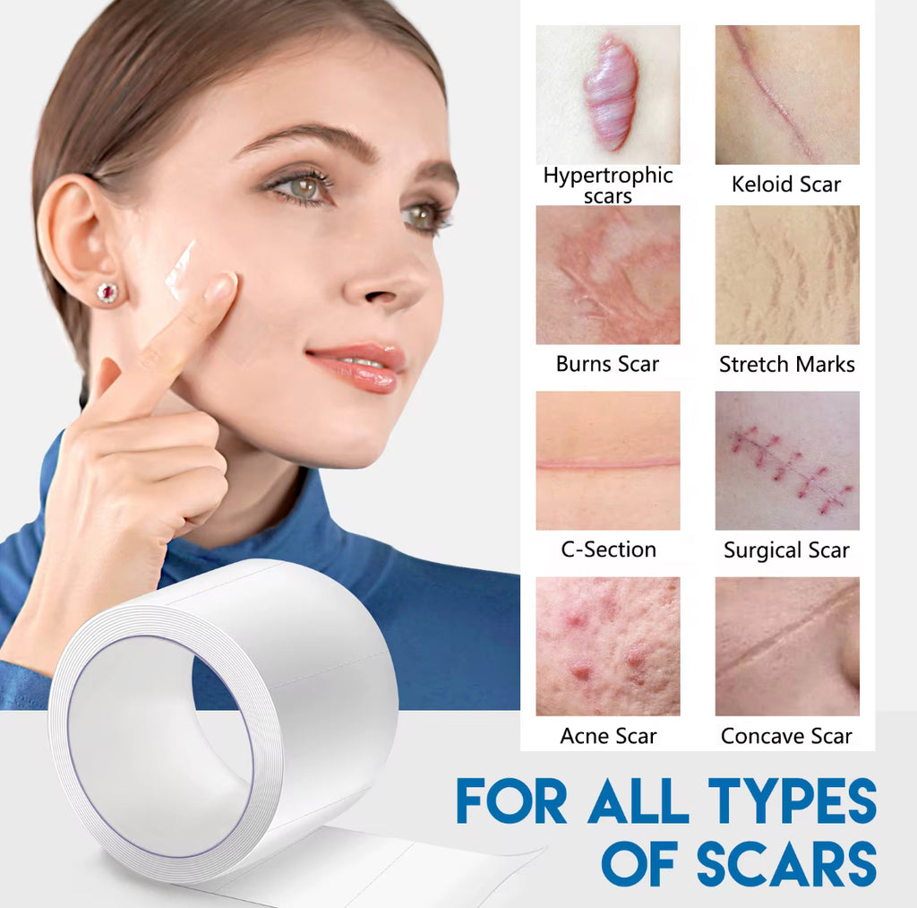 Clear Silicone Scar Sheets