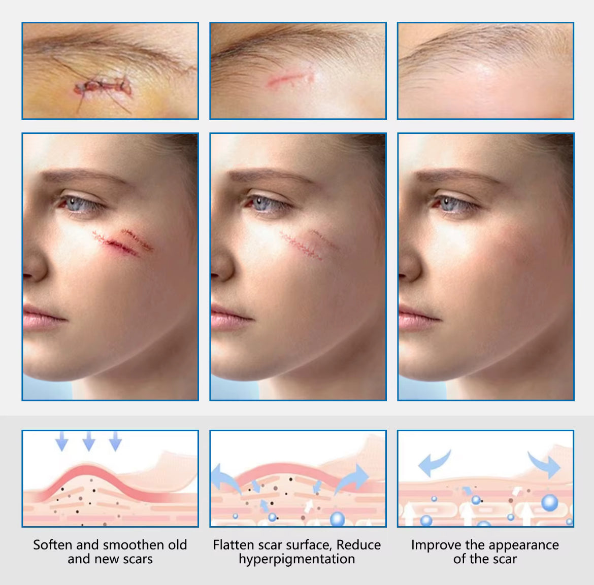 Clear Silicone Scar Sheets